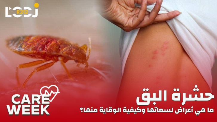 Care Week : حشرة البق، ما هي أعراض لسعاتها وكيفية الوقاية منها؟