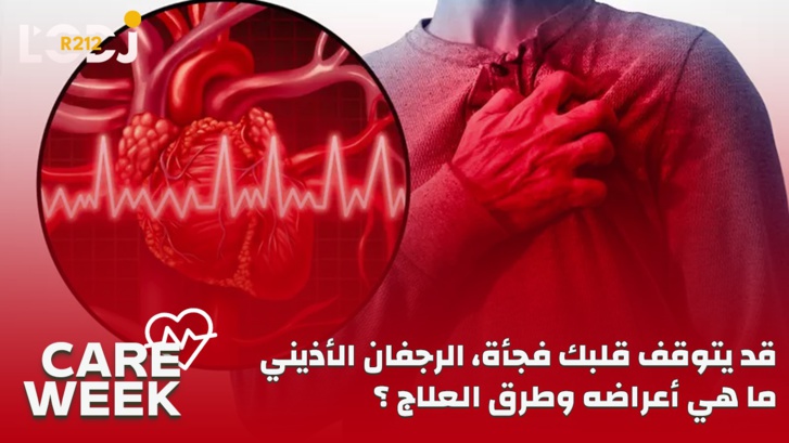 Care Week : قد يتوقف قلبك فجأة، الرجفان الأذيني، ما هي أعراضه وطرق العلاج؟