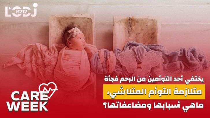 Care Week : يختفي أحد التوأمين من الرحم فجأة، متلازمة التوأم المتلاشي، ماهي أسبابها ومضاعفاتها