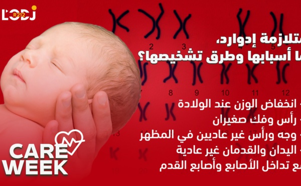 Care Week : رُضَّع يموتون بعد أسبوعٍ واحد، متلازمة إدوارد، ما أسبابها وطرق تشخيصها ؟