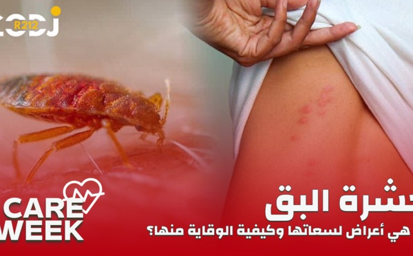 Care Week : حشرة البق، ما هي أعراض لسعاتها وكيفية الوقاية منها؟