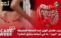 Care Week :  يسبب فقدان الوزن لحد النحافة المفرطة ، مرض "كرون"، ما هي أعراضه وطرق العلاج