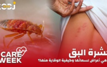 Care Week : حشرة البق، ما هي أعراض لسعاتها وكيفية الوقاية منها؟